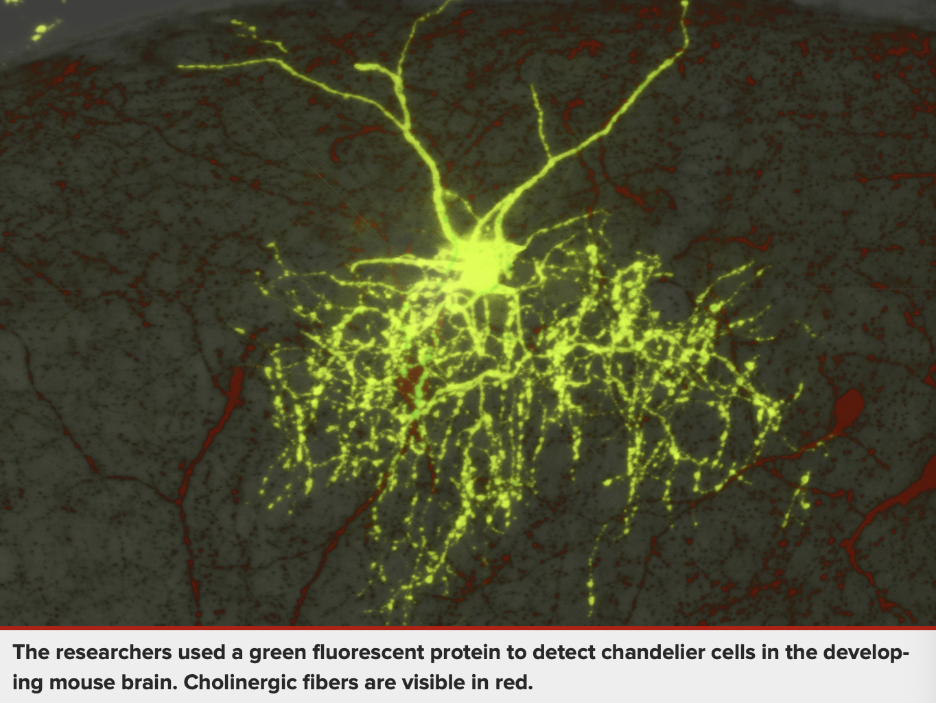 The researchers used a green fluorescent protein to detect chandelier cells in the developing mouse brain. Cholinergic fibers are visible in red.