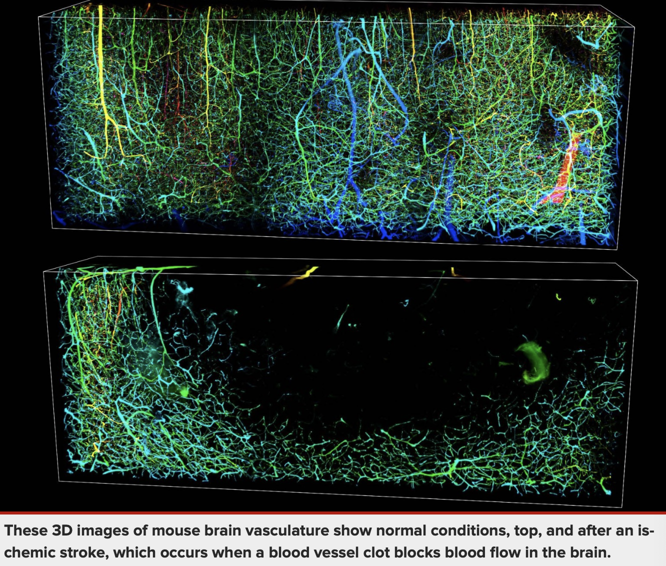 These 3D images of mouse brain vasculature show normal conditions, top, and after an ischemic stroke, which occurs when a blood vessel clot blocks blood flow in the brain.