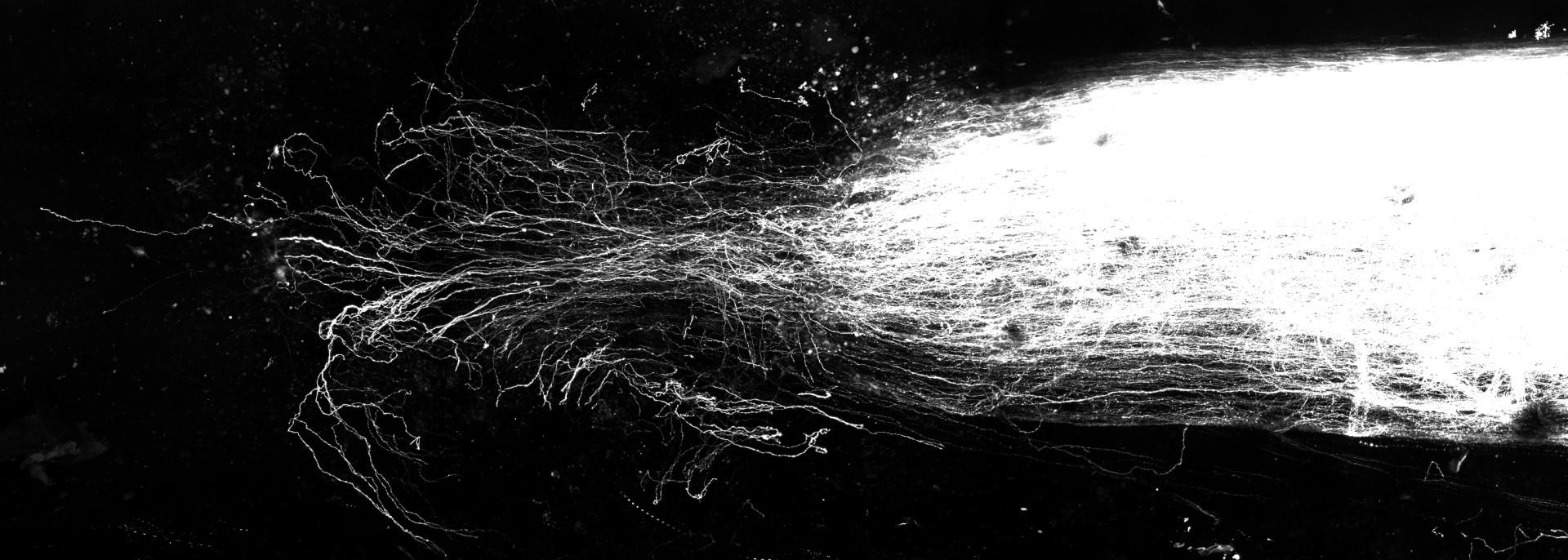 Imaging shows regeneration of sensory axons four weeks after a spinal cord injury in an adult mouse injected with PDGF-BB at the lesion site.