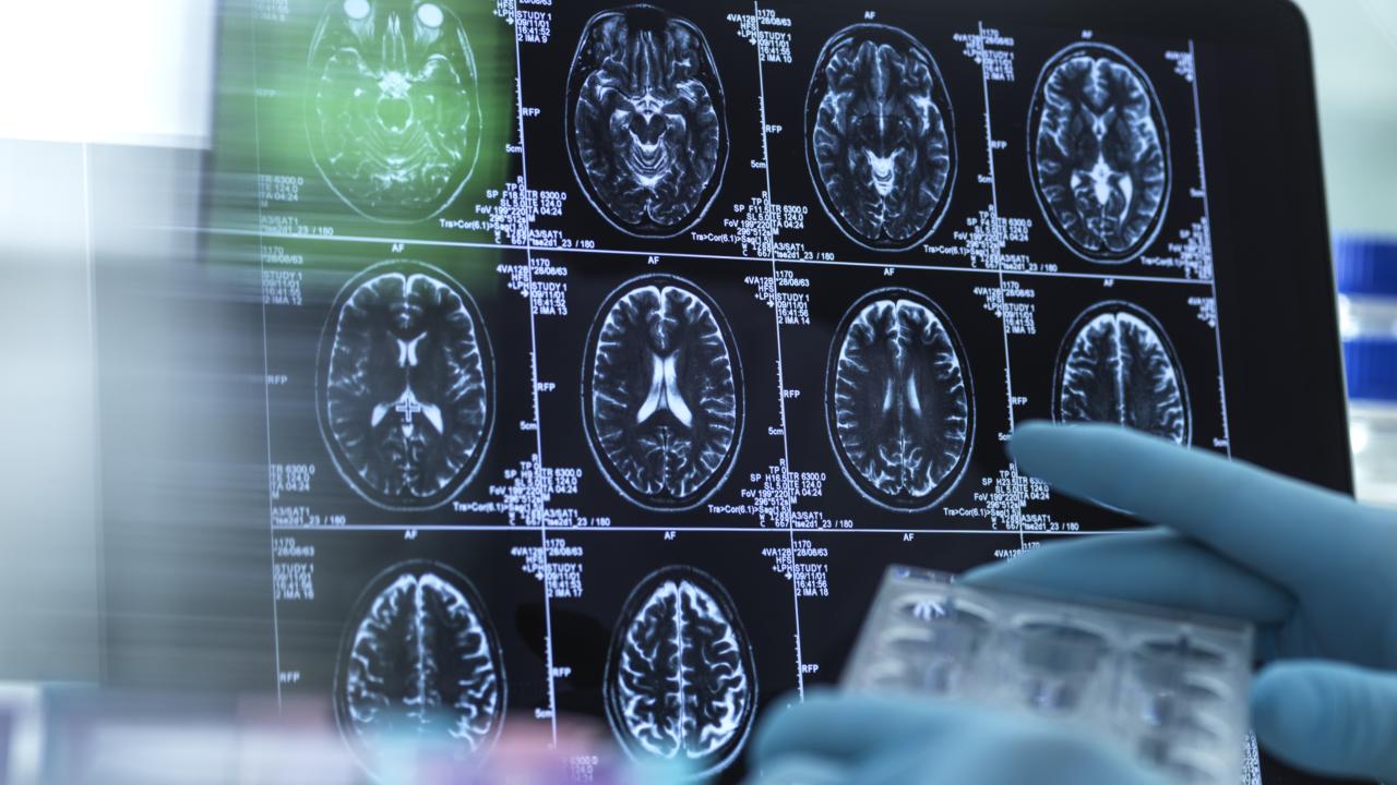 Neurology research, conceptual image. Scientist preparing a multi well plate in front of brain scans.
